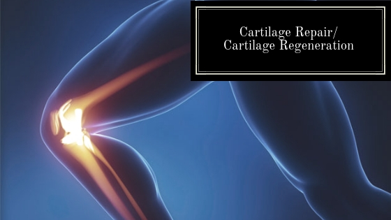 Cartilage Repair Cartilage Regeneration
